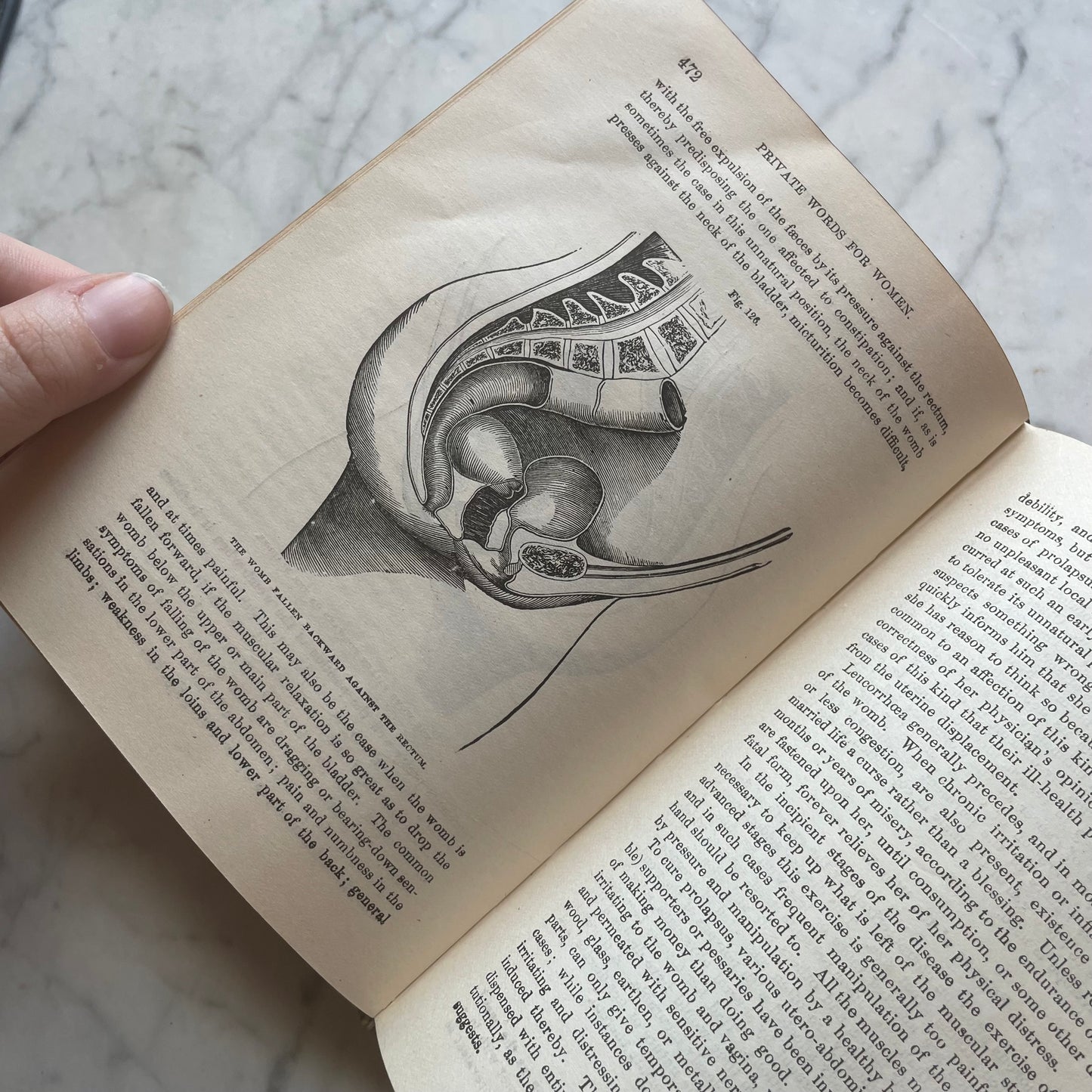 Victorian Medical Book | Plain Home Talks | 1858
