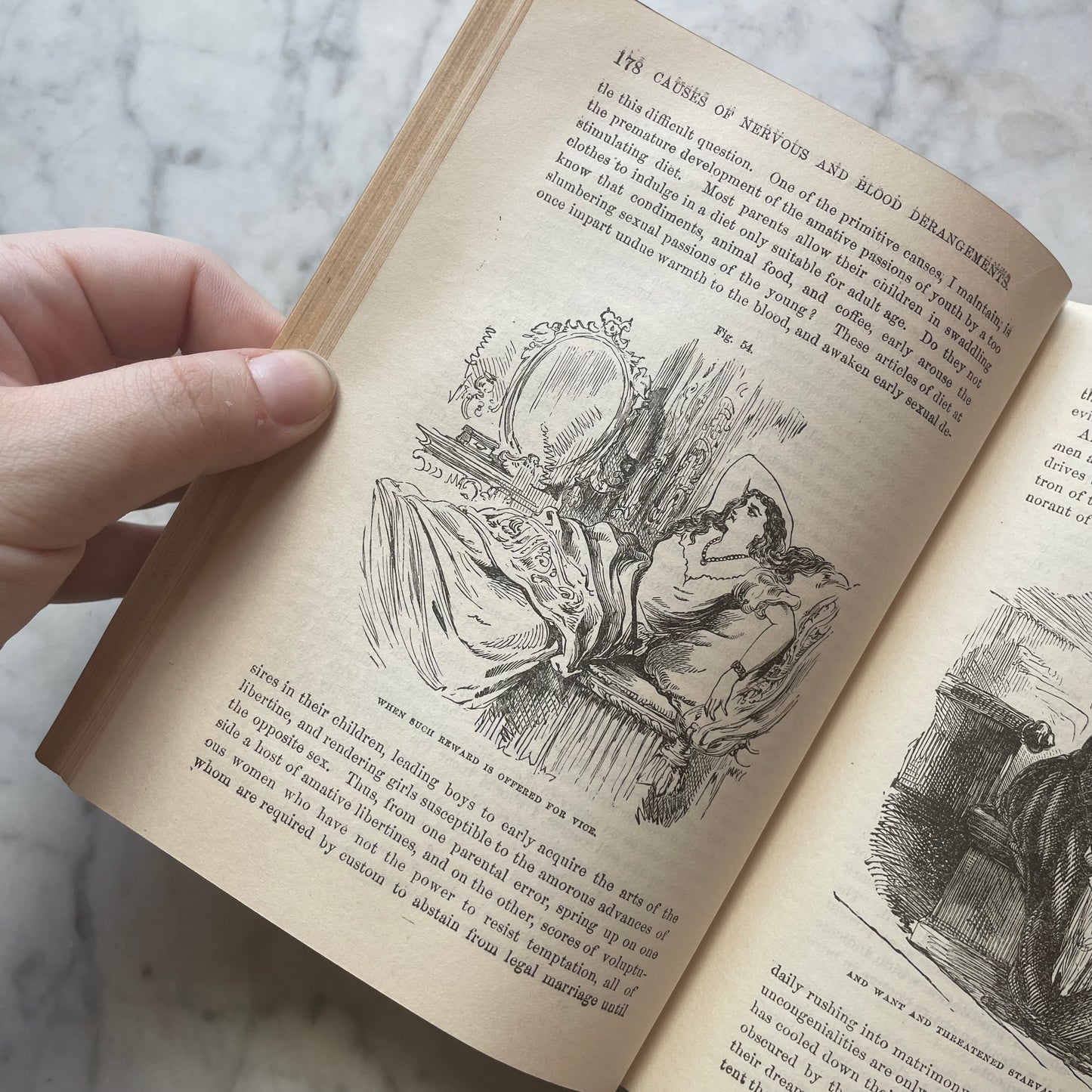 Victorian Medical Book | Plain Home Talks | 1858