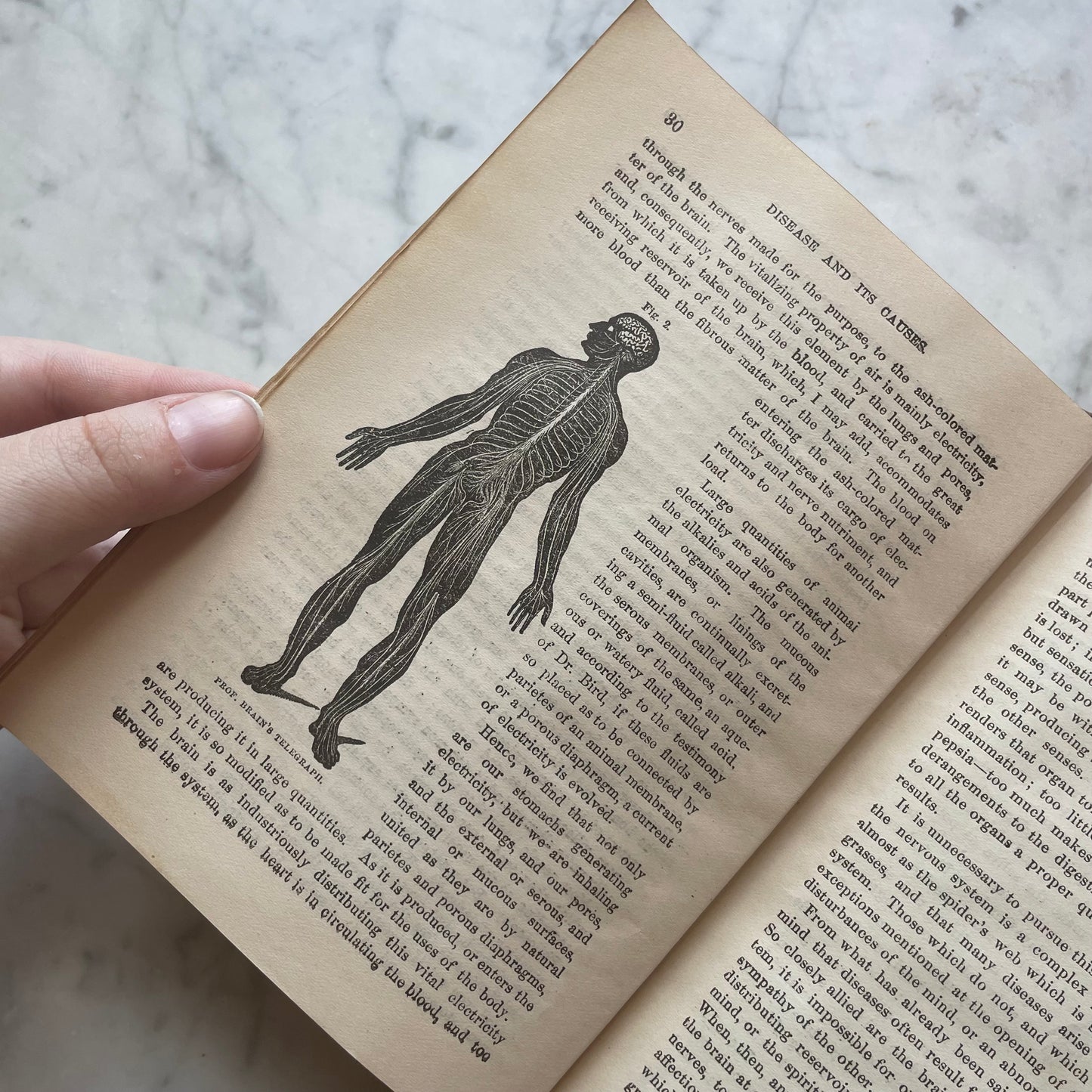 Victorian Medical Book | Plain Home Talks | 1858