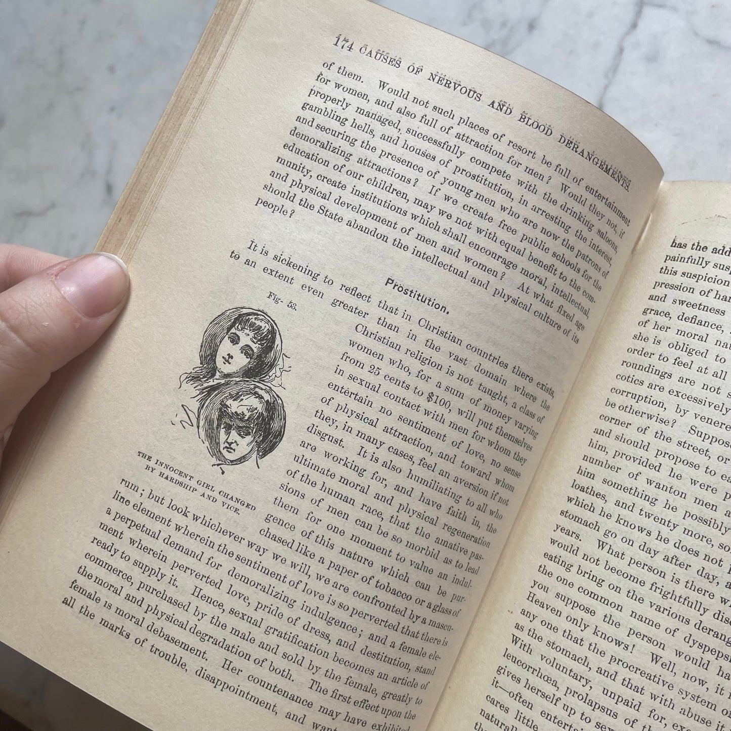 Victorian Medical Book | Plain Home Talks | 1858