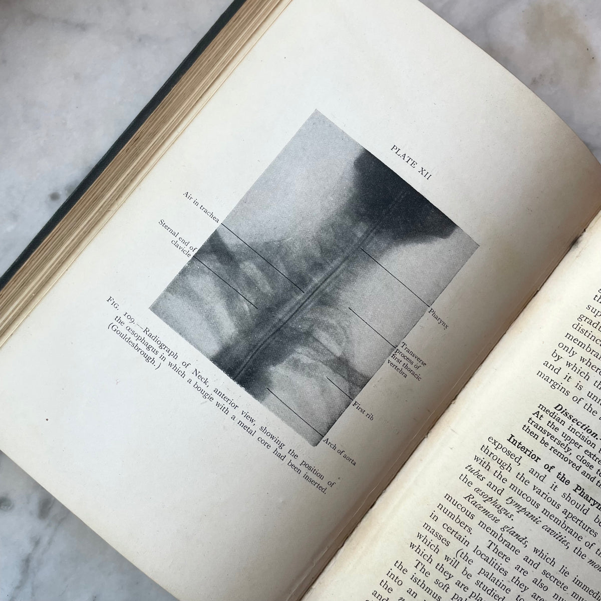 Cunningham’s Manual of Practical Anatomy | Volume III: Head and Neck | 1920